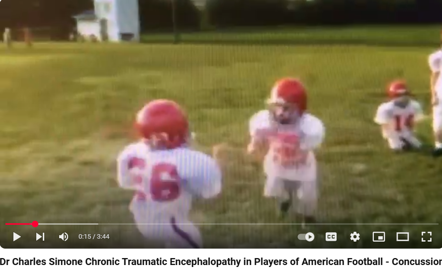 CHRONIC TRAUMATIC ENCEPHALOPATHY (CTE) IN PLAYERS OF AMERICAN FOOTBALL